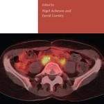 Gynaecological Oncology for the MRCOG and Beyond, 2e