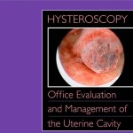 Hysteroscopy: Office Evaluation and Management of the Uterine Cavity