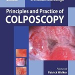 Principles and Practice of Colposcopy, 2nd Edition