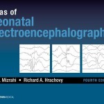 Atlas of Neonatal Electroencephalography, 4th Edition