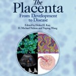 The Placenta: From Development to Disease