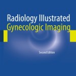 Radiology Illustrated: Gynecologic Imaging, 2nd Edition