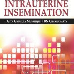 IUI: Intrauterine Insemination