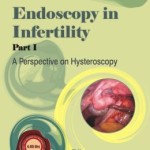 Endoscopy in Infertility – Part I A Perspective on Hysteroscopy – ECAB