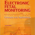 Electronic Fetal Monitoring: Concepts and Applications Edition 2