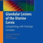 Glandular Lesions of the Uterine Cervix: Cytopathology with Histologic Correlates