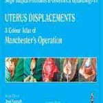 UTERUS DISPLACEMENTS: A Colour Atlas of Manchester’s Operation (Volume 17)