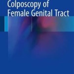 Colposcopy of Female Genital Tract 2017