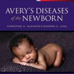 Avery’s Diseases of the Newborn
