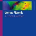Uterine Fibroids : A Clinical Casebook