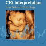 Handbook of CTG Interpretation : From Patterns to Physiology