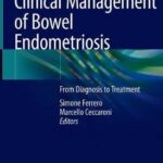 Clinical Management of Bowel Endometriosis : From Diagnosis to Treatment