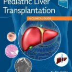 Pediatric Liver Transplantation : A Clinical Guide